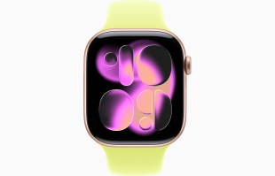 Apple Watch Series 11 // 46мм GPS // Корпус из алюминия цвета "розовое золото", спортивный ремешок цвета "неоновый желтый"